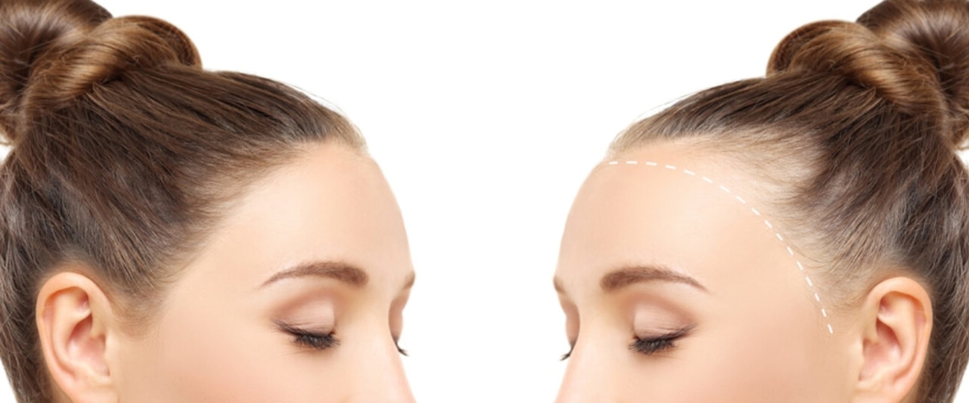 Hair Care Routine for Managing Female Hair Loss: Tips and Solutions