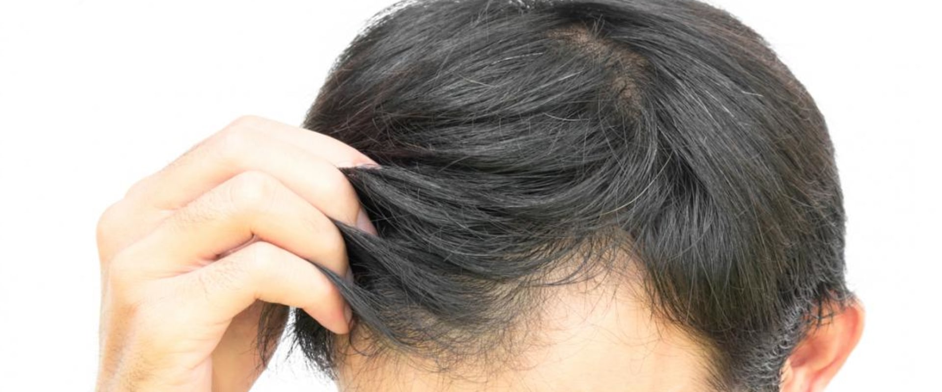 Preventing Hair Loss: Lifestyle Changes That Can Make a Difference