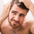 Lifestyle Changes for Preventing Male Pattern Baldness: Tips and Solutions