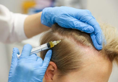 A Comprehensive Guide to Hair Transplants