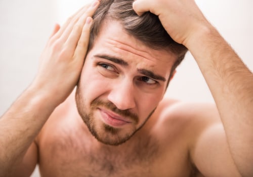 Lifestyle Changes for Preventing Male Pattern Baldness: Tips and Solutions